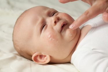 penyebab dan cara mengatasi iritasi kulit pada bayi